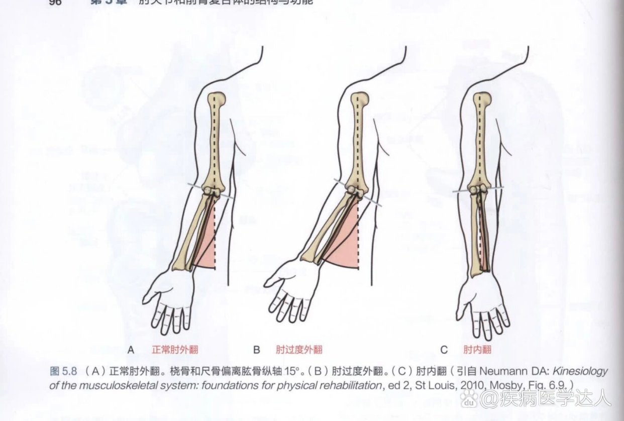 肘内翻最新矫正技术，重塑关节功能，提升生活品质